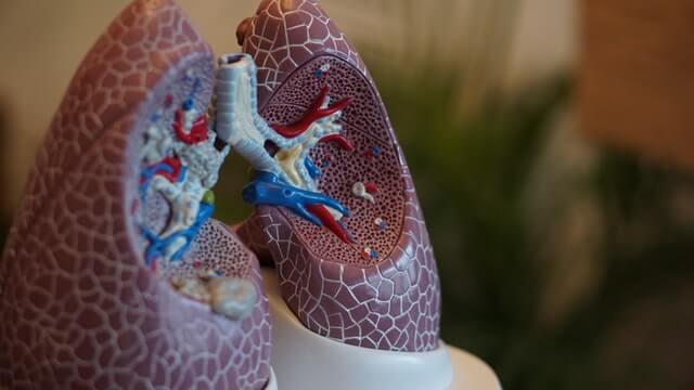 Tuberculose: O que é, sintomas e muito mais!
