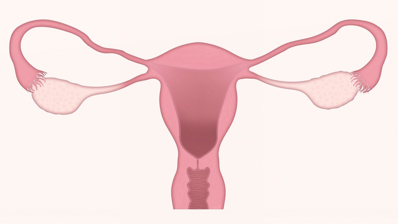 Endometriose: o que é, sintomas e muito mais!
