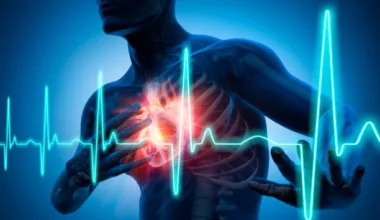 IAMCSST - infarto agudo do miocárdio com supra de ST