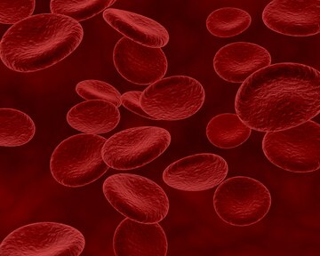ResuMED de anemias: classificação das anemias e avaliação de hemogramas