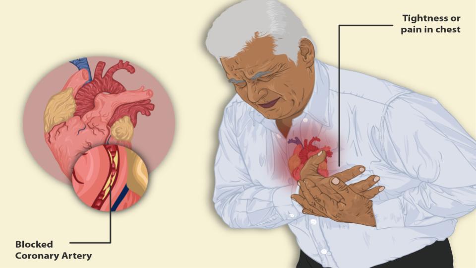 ResuMED de cardiologia: Síndrome coronariana aguda sem supra do segmento ST (SCASSST)