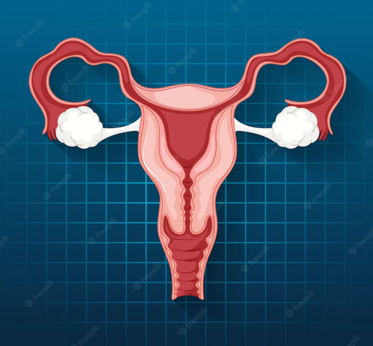 ResuMED de miomatose uterina: fisiopatologia, clínica, diagnóstico, tratamento e mais!