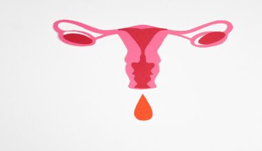 Endometriose - Estratégia