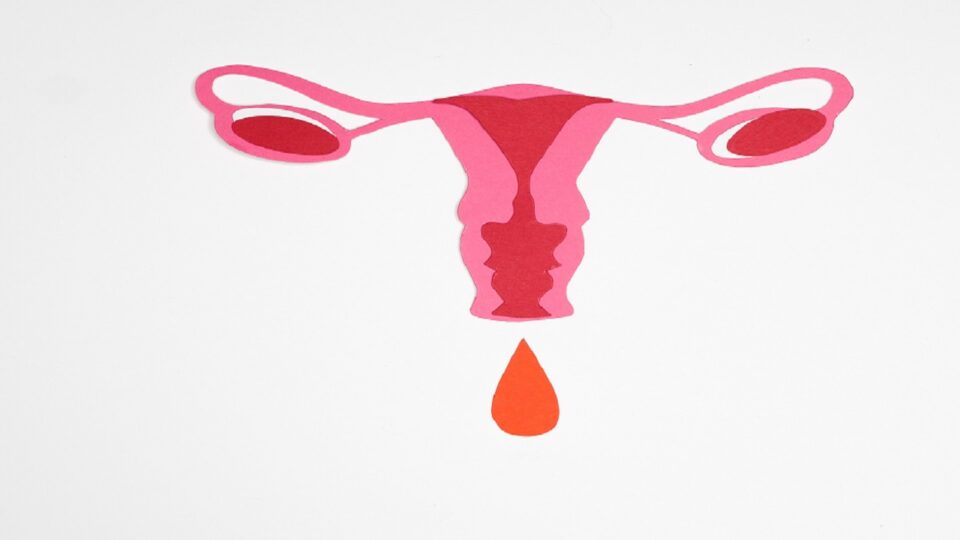 Resumo de endometriose: manifestações clínicas, diagnóstico, tratamento e mais!