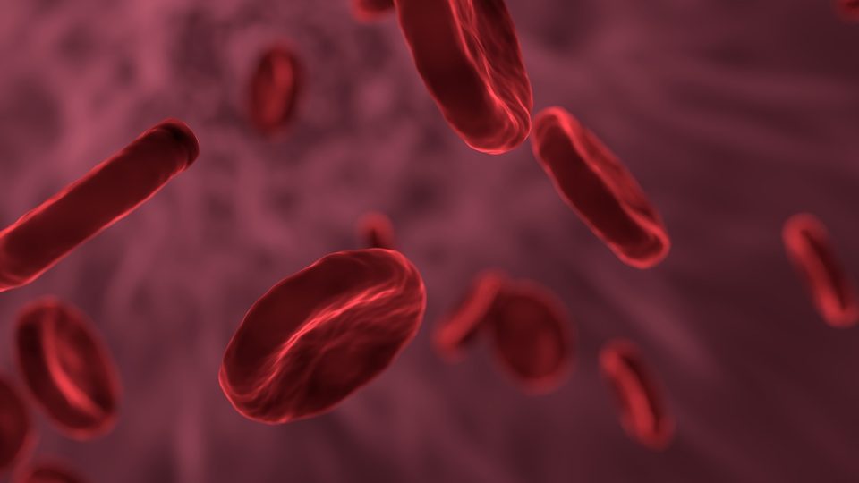 Resumo de anemia falciforme: diagnóstico, tratamento e mais!