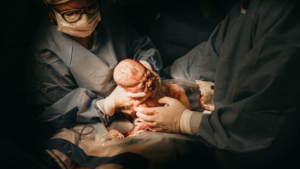 Resumo sobre descolamento prematuro de placenta: diagnóstico, tratamento e mais!