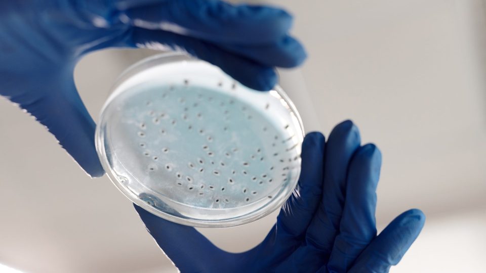 Resumo de Escherichia coli produtora de toxina shiga: diagnóstico, tratamento e mais!