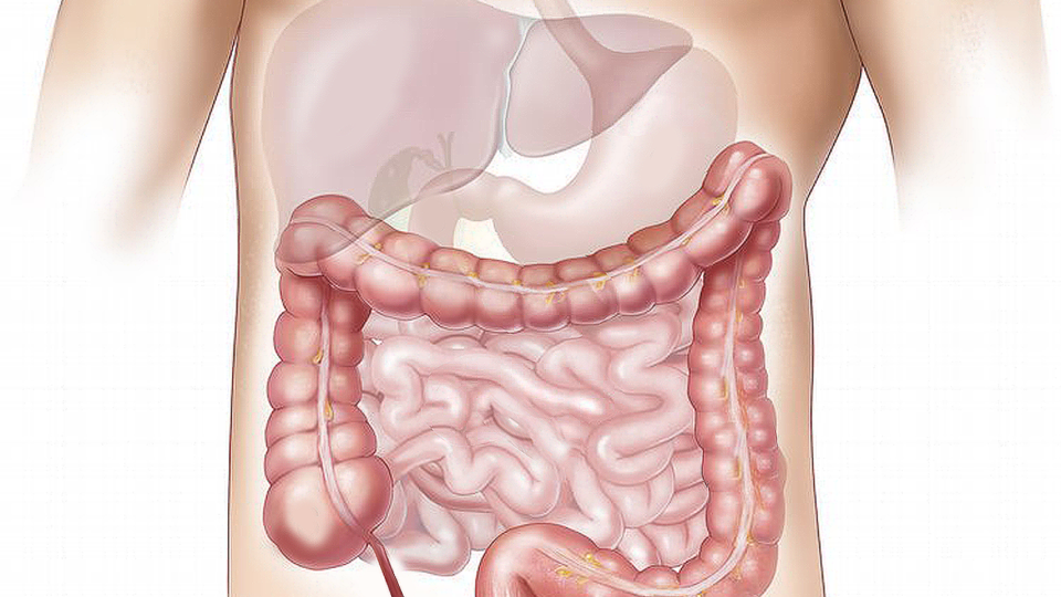 Resumo do apêndice vermiforme: diagnóstico, tratamento e mais!