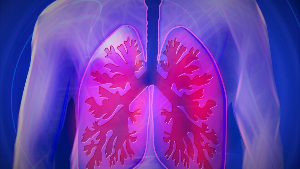 Resumo de edema agudo pulmonar: diagnóstico, tratamento e mais!