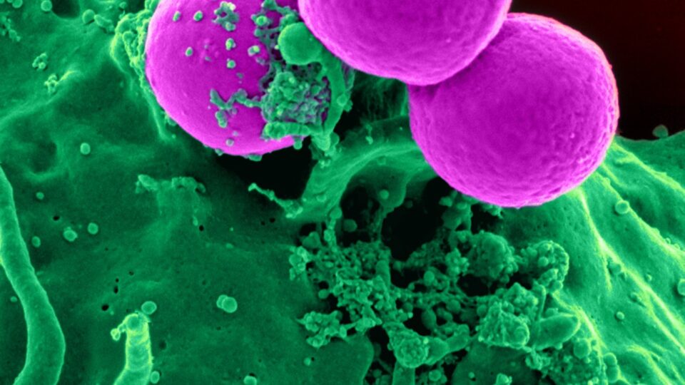 Resumo de <em>Staphylococcus aureus</em>: diagnóstico, tratamento e mais!