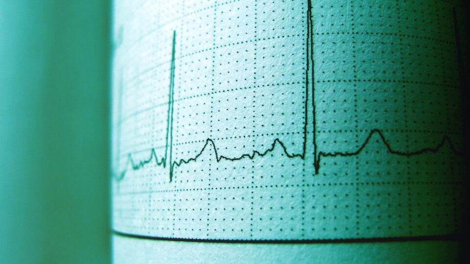 Resumo de eletrocardiograma nos distúrbios hidroeletrolíticos: alterações, como identificar e mais!