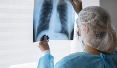 5 Questões sobre Pneumonia que já caíram nas provas (Foto: Freepik)